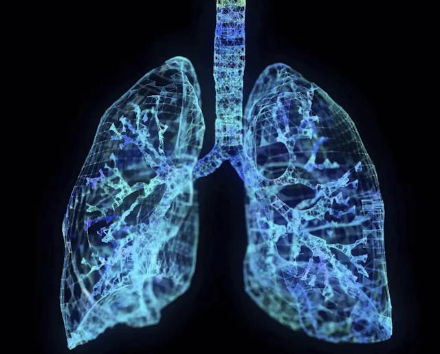 The Groundbreaking Way To Search Lungs For Signs Of Covid-19